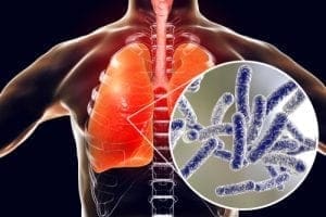 acqua calda sanitaria & solare termico - Il rame è un antibatterico efficace, io lo uso in casa, nelle rubinetterie e... 11